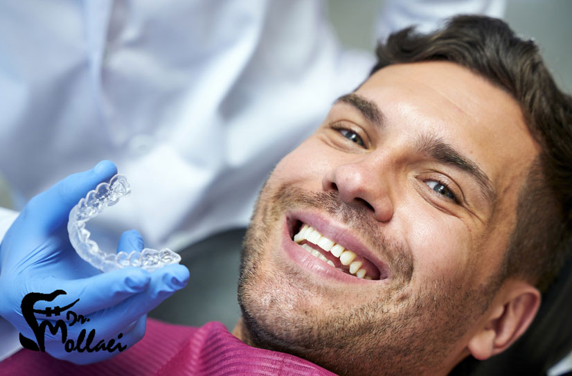 یکی دیگر از روش‌های انجام ارتودنسی، استفاده از نوع ثابت آن است که بر روی دندان‌ها می‌چسبد و نمی‌توان براکت‌های آن را جدا کرد. 