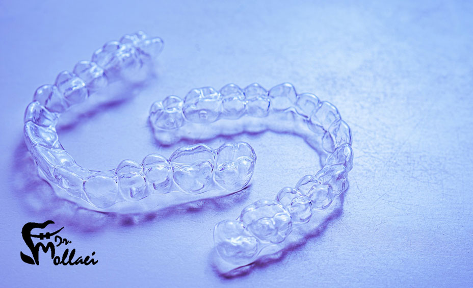 استفاده از ارتودنسی متحرک در سنین پایین می‌تواند باعث شود که احتمال درمان ناهنجاری‌های فک و دندان افزایش پیدا کند؛ اما افراد بالای ۲۰ سال هم درصورتی‌که از مشکلات خفیف رنج می‌برند می‌توانند از این روش استفاده کنند. 
