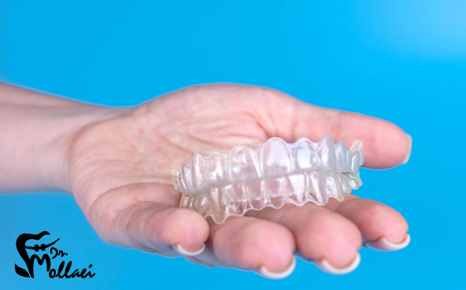 همانطور که از نام آن پیداست، ارتودنسی متحرک شامل دستگاه‌هایی است که می‌توان آن‌ها را از دهان خارج کرد.
