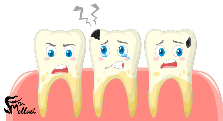 بلیچینگ، یکی از رایج ترین و موثرترین روش های سفید شدن دندان در دندانپزشکی است.