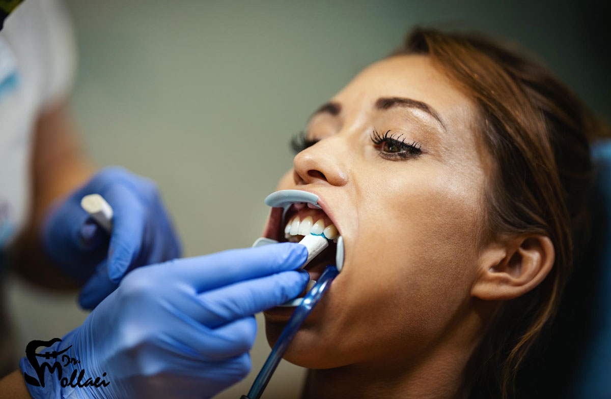 درمان کانال ریشه یا عصب کشی دندان چگونه است؟
