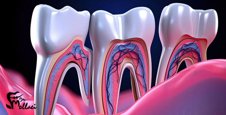 عصب کشی دندان چگونه است؟