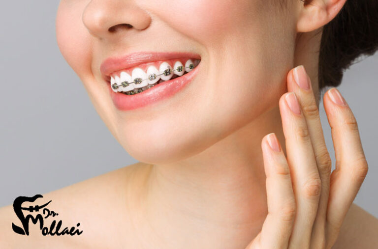 متخصص ارتودنسی