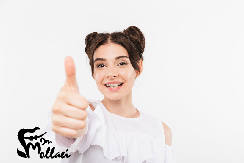 ارتودنسی ثابت