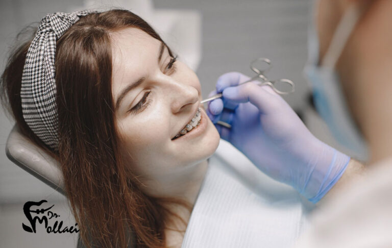 ارتودنسی دندان